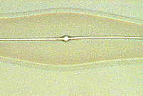Pleurosigma angulatum