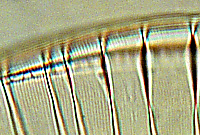 Surirella gemma