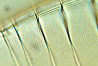 Surirella gemma