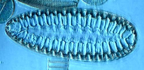 fossile Diatomeen