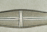 Stauroneis phoenicenteron