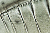 Surirella gemma