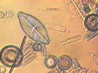 Fossile Kieselagen - DIC
