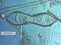 Fossile Kieselagen - DIC