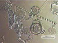 Fossile Kieselagen - DIC